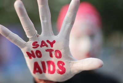 愛滋病毒 / 愛滋病後的生活